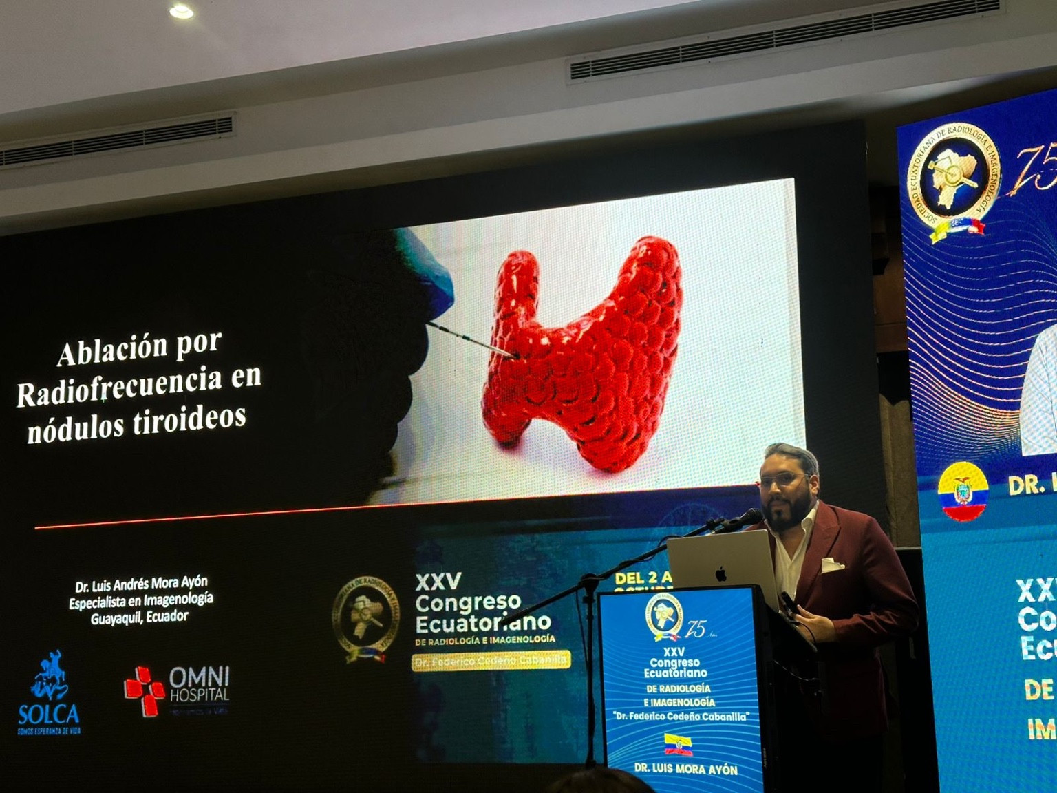 Exposición sobre ablación por radiofrecuencia en nódulos tiroideos en un congreso de radiología